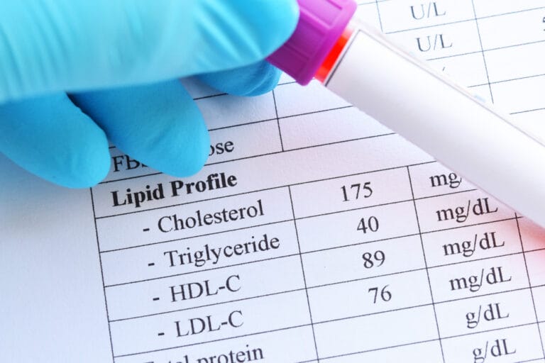 normal lipid profile test result with blood sample tube